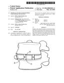 MINIMALLY INVASIVE INTERVERTEBRAL STAPLE DISTRACTION DEVICES diagram and image