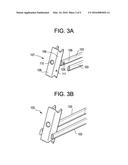 MINIMALLY INVASIVE INTERVERTEBRAL STAPLE DISTRACTION DEVICES diagram and image