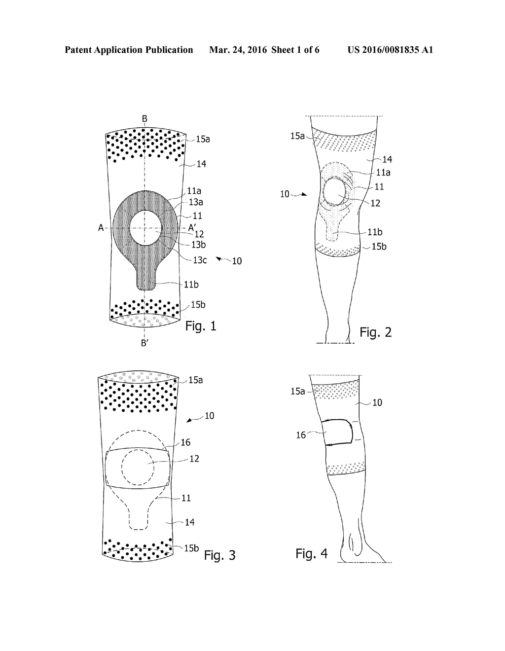 PROPRIOCEPTIVE ORTHOSIS FOR SUPPORTING A JOINT - diagram, schematic, and image 02