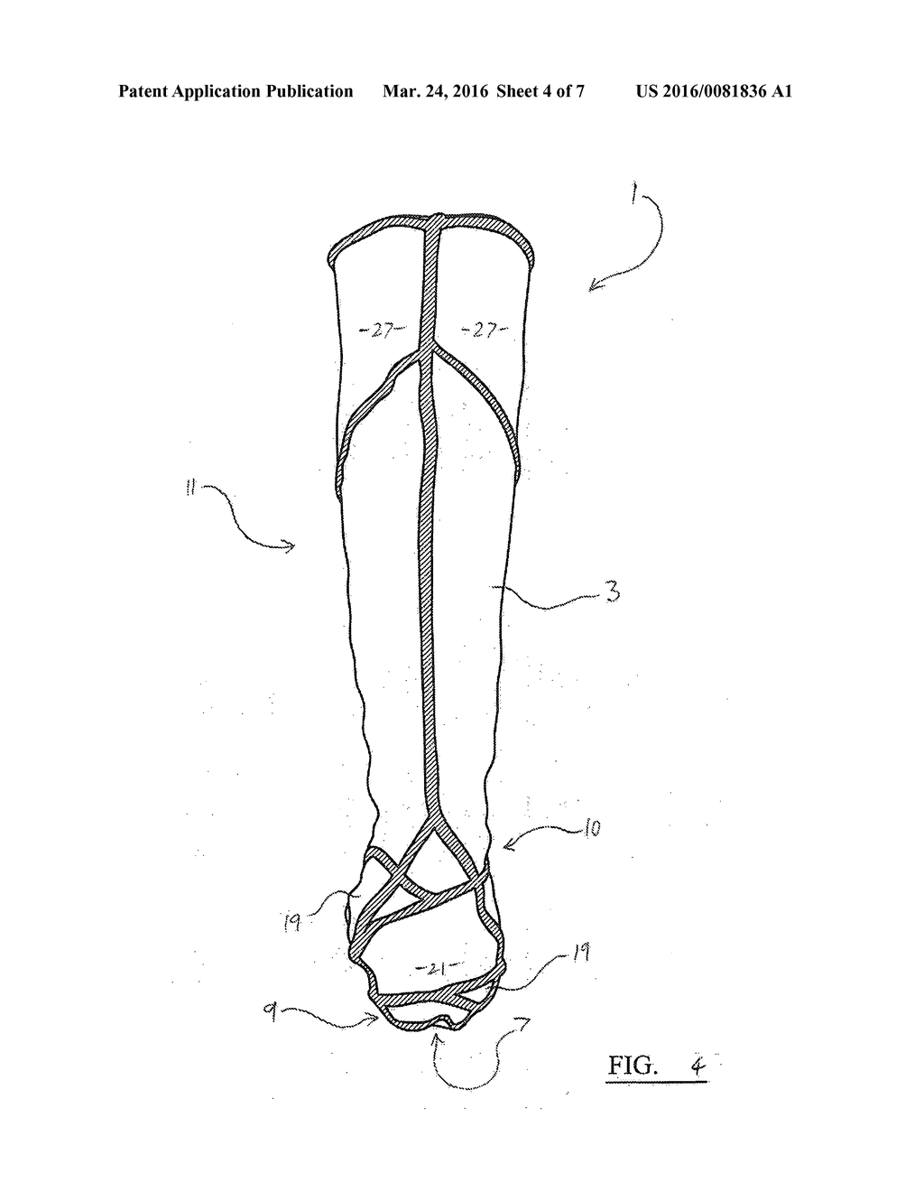 ORTHOTIC FOOT SUPPORT - diagram, schematic, and image 05