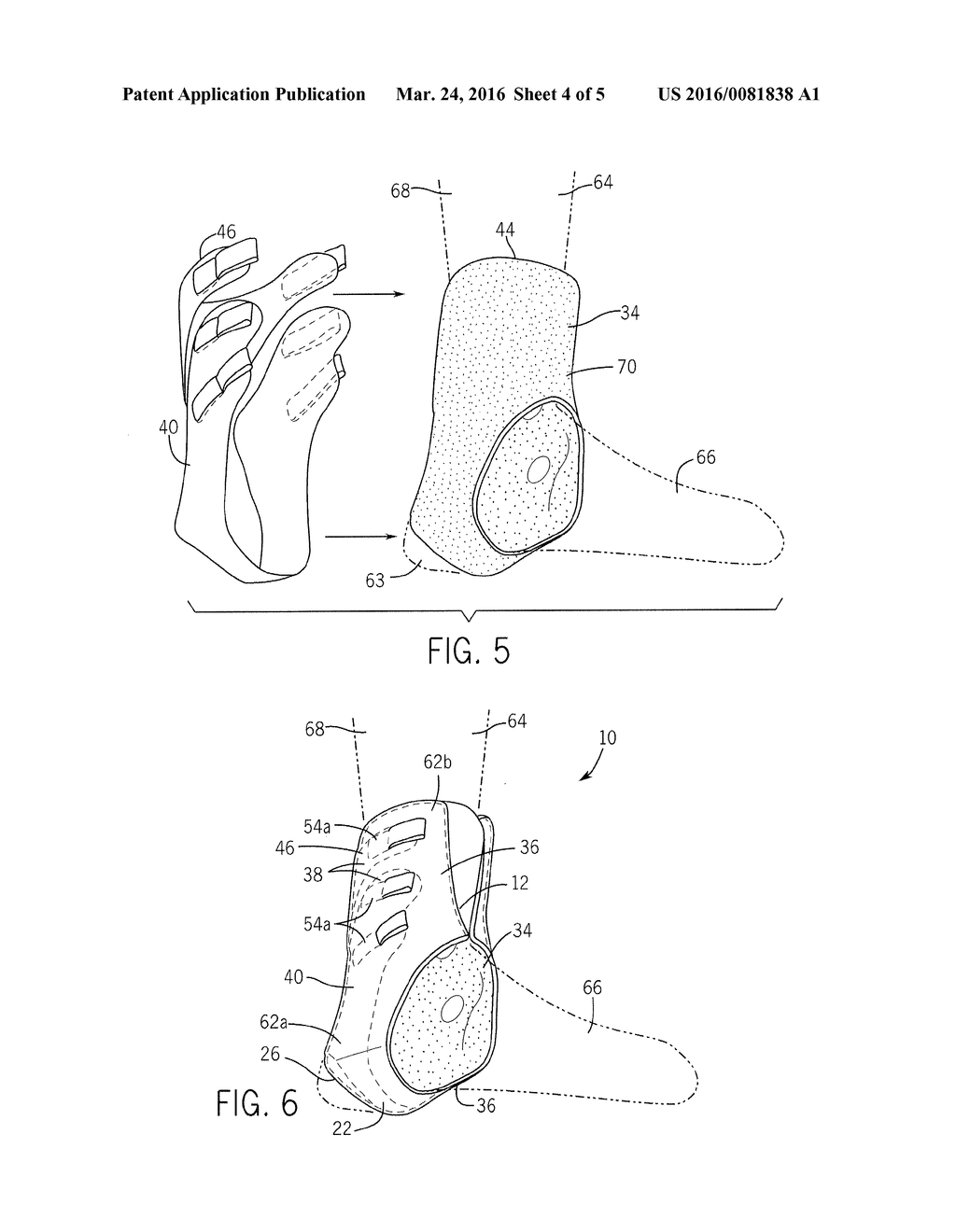 ANKLE SUPPORT BRACE (ASB) AND METHOD OF MAKING THE SAME - diagram, schematic, and image 05