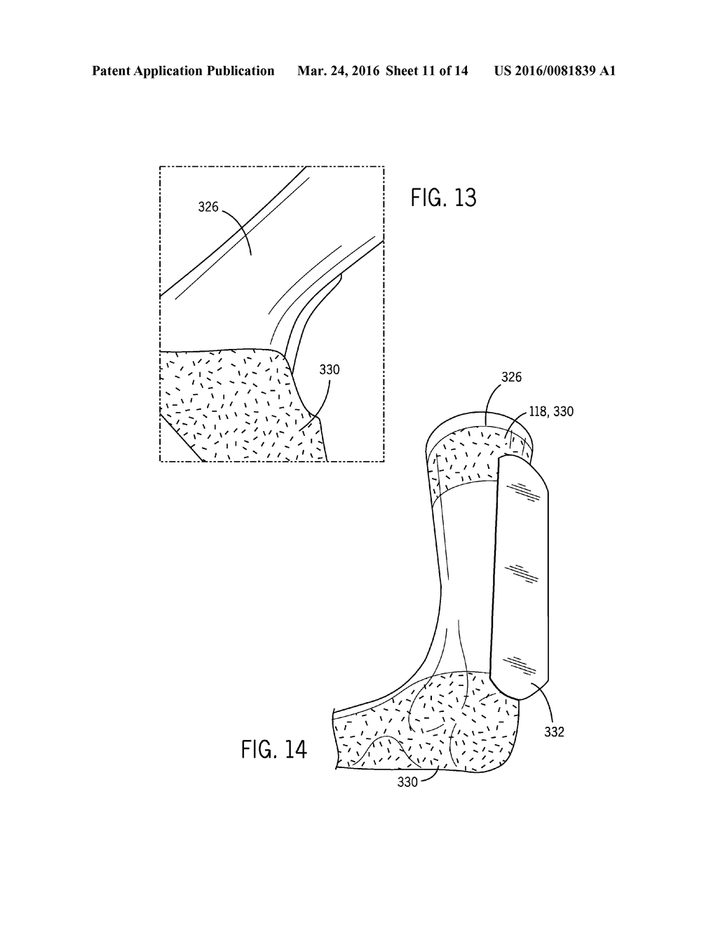 Ankle-Foot Orthosis and Method of Manufacture - diagram, schematic, and image 12