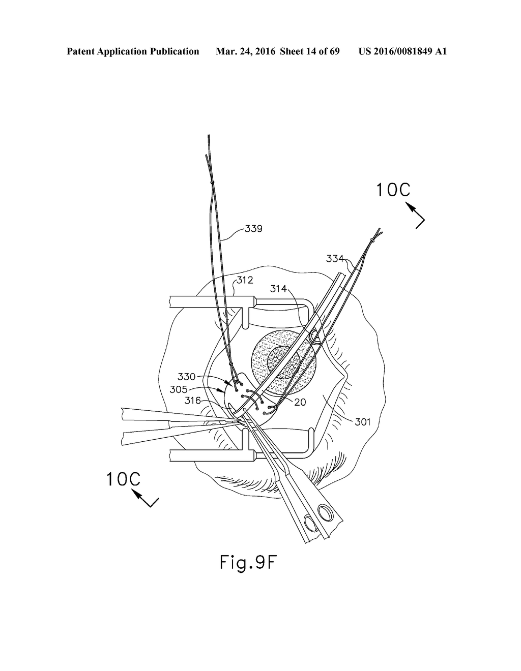 THERAPEUTIC AGENT DELIVERY DEVICE - diagram, schematic, and image 15