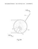 THERAPEUTIC AGENT DELIVERY DEVICE diagram and image