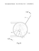 THERAPEUTIC AGENT DELIVERY DEVICE diagram and image