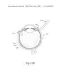 THERAPEUTIC AGENT DELIVERY DEVICE diagram and image