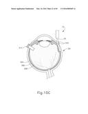 THERAPEUTIC AGENT DELIVERY DEVICE diagram and image