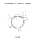 THERAPEUTIC AGENT DELIVERY DEVICE diagram and image