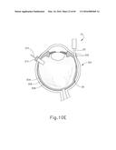 THERAPEUTIC AGENT DELIVERY DEVICE diagram and image