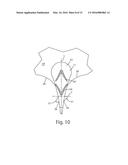 ABSORBENT ARTICLE HAVING A FUNCTIONAL ENHANCEMENT INDICATOR diagram and image