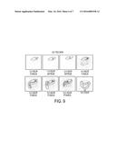 ACAMPROSATE FORMULATIONS, METHODS OF USING THE SAME, AND COMBINATIONS     COMPRISING THE SAME diagram and image