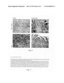 IMMUNOMODULATING GENE THERAPY diagram and image