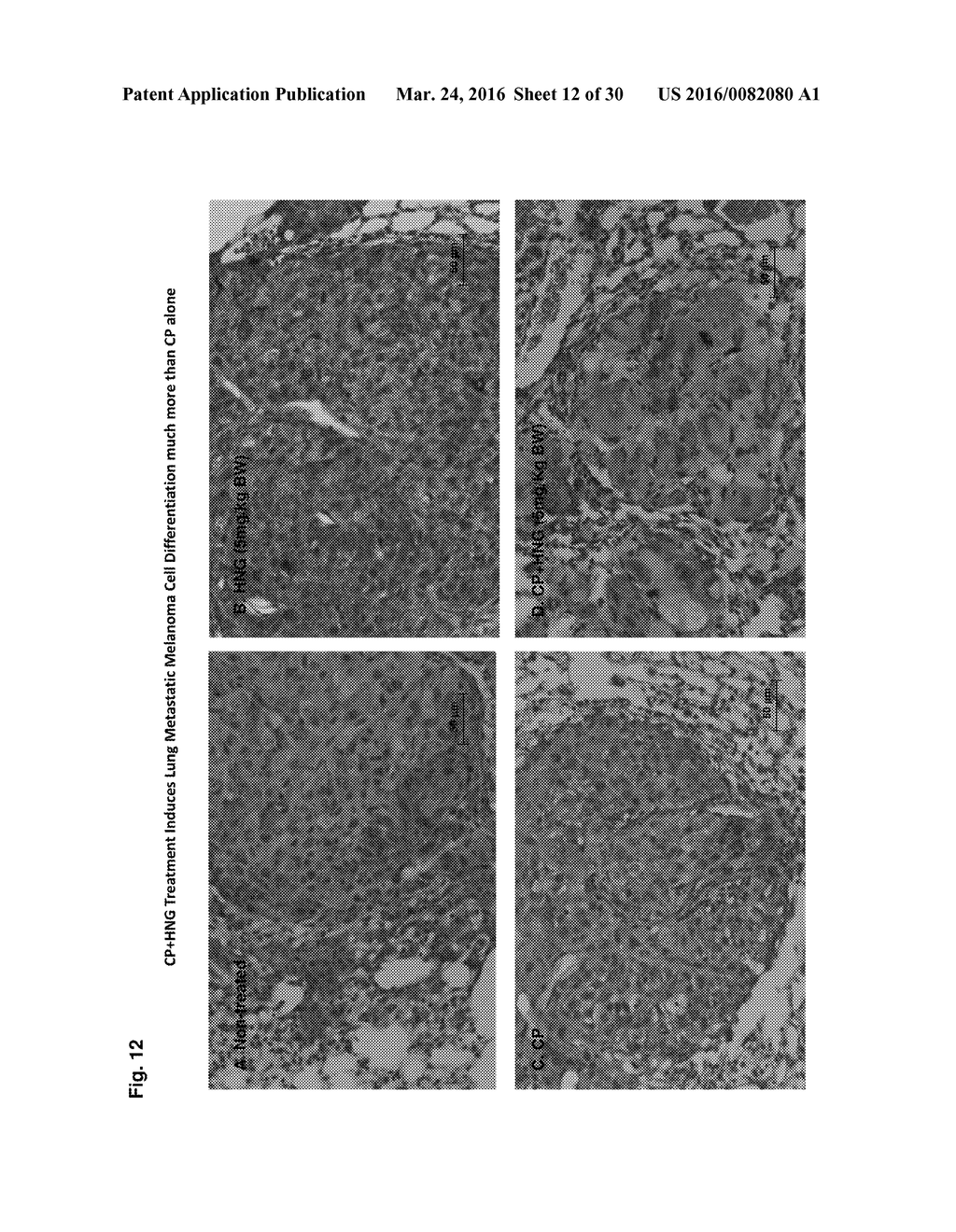 HUMANIN, ANALOGS AND CANCER TREATMENT METHODS AND USES THEREOF - diagram, schematic, and image 13