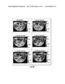 COMPOSITIONS AND METHODS FOR CHEMICAL EXCHANGE SATURATION TRANSFER (CEST)     BASED MAGNETIC RESONANCE IMAGING (MRI) diagram and image