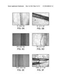 CHITIN AND ALGINATE COMPOSITE FIBERS diagram and image