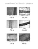 CHITIN AND ALGINATE COMPOSITE FIBERS diagram and image