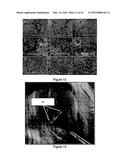 PERIPHERAL NERVE GROWTH CONDUIT diagram and image