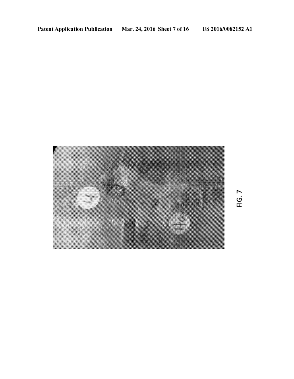 Birth Tissue Material and Method of Preparation - diagram, schematic, and image 08