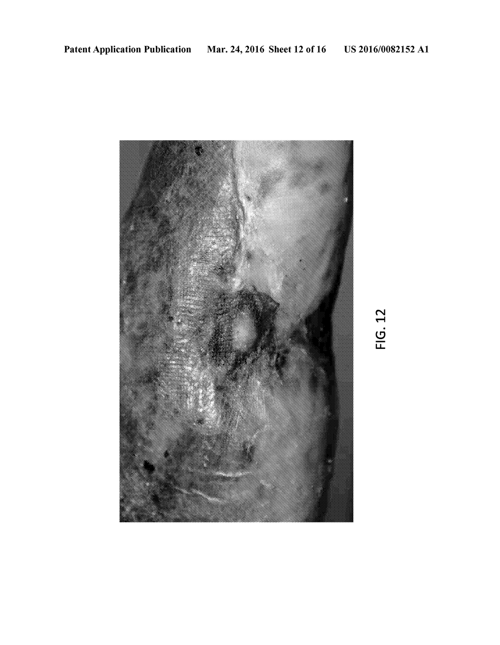 Birth Tissue Material and Method of Preparation - diagram, schematic, and image 13