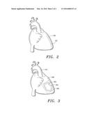 Method and System for Treatment of Damaged Biological Tissue diagram and image