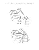 Delivery Device and Method diagram and image