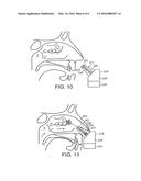 Delivery Device and Method diagram and image