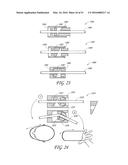 AUTOMATICALLY ADJUSTING HEADGEAR FOR PATIENT INTERFACE diagram and image