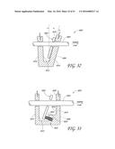 AUTOMATICALLY ADJUSTING HEADGEAR FOR PATIENT INTERFACE diagram and image