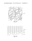 AUTOMATICALLY ADJUSTING HEADGEAR FOR PATIENT INTERFACE diagram and image