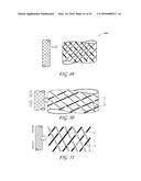 AUTOMATICALLY ADJUSTING HEADGEAR FOR PATIENT INTERFACE diagram and image