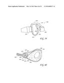 AUTOMATICALLY ADJUSTING HEADGEAR FOR PATIENT INTERFACE diagram and image