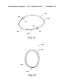 AUTOMATICALLY ADJUSTING HEADGEAR FOR PATIENT INTERFACE diagram and image