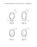 AUTOMATICALLY ADJUSTING HEADGEAR FOR PATIENT INTERFACE diagram and image