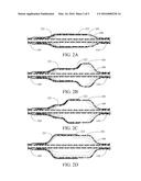 COMPLIANT SLEEVE FOR VASCULAR BALLOON diagram and image