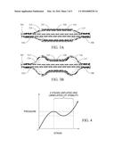 COMPLIANT SLEEVE FOR VASCULAR BALLOON diagram and image