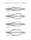 COMPLIANT SLEEVE FOR VASCULAR BALLOON diagram and image