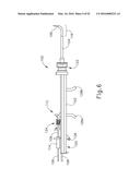 BALLOON CATHETER ASSEMBLY diagram and image