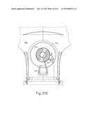 BALLOON CATHETER ASSEMBLY diagram and image