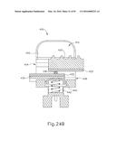 BALLOON CATHETER ASSEMBLY diagram and image