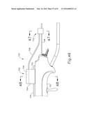 BALLOON CATHETER ASSEMBLY diagram and image