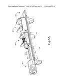 BALLOON CATHETER ASSEMBLY diagram and image