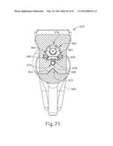 BALLOON CATHETER ASSEMBLY diagram and image