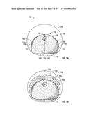 SYSTEMS AND METHODS FOR A TISSUE EXPANDER diagram and image