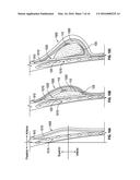 SYSTEMS AND METHODS FOR A TISSUE EXPANDER diagram and image