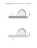 SYSTEMS AND METHODS FOR A TISSUE EXPANDER diagram and image