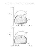 SYSTEMS AND METHODS FOR A TISSUE EXPANDER diagram and image