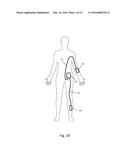 APPARATUS AND METHODS FOR CONTROLLING TISSUE OXYGENATION FOR WOUND HEALING     AND PROMOTING TISSUE VIABILITY diagram and image