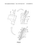 MICRONEEDLE ARRAY AND MICRONEEDLE ARRAY DEVICE diagram and image