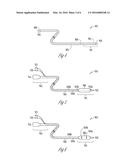 METHOD AND APPARATUS FOR PACING DURING REVASCULARIZATION diagram and image