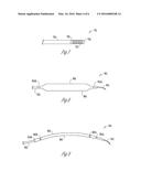 METHOD AND APPARATUS FOR PACING DURING REVASCULARIZATION diagram and image